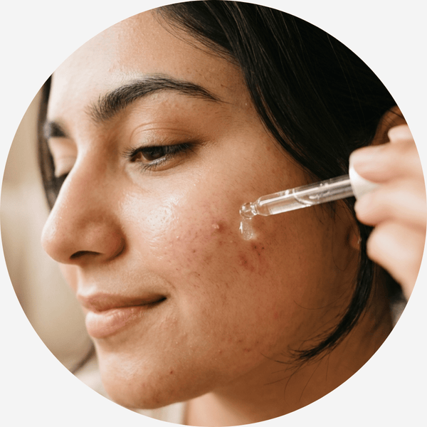 Acne & Spots