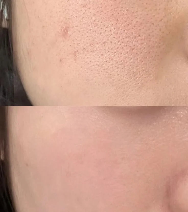 Niacinamide & Zinc (Face serum)