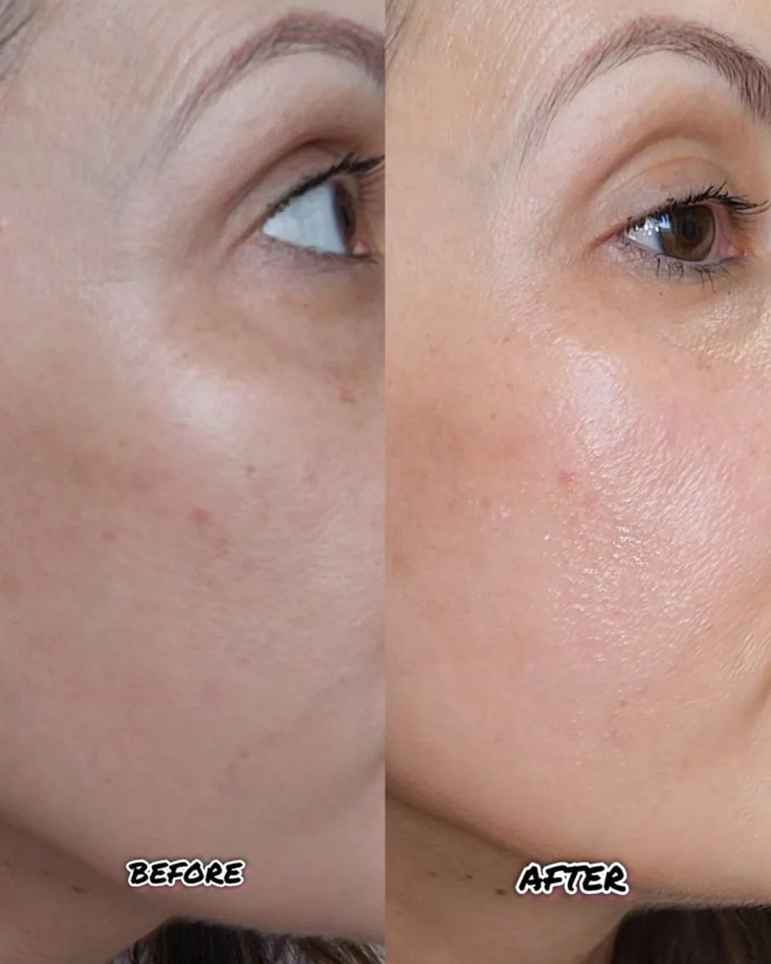 Instant Glow Action - 3 In One Facial