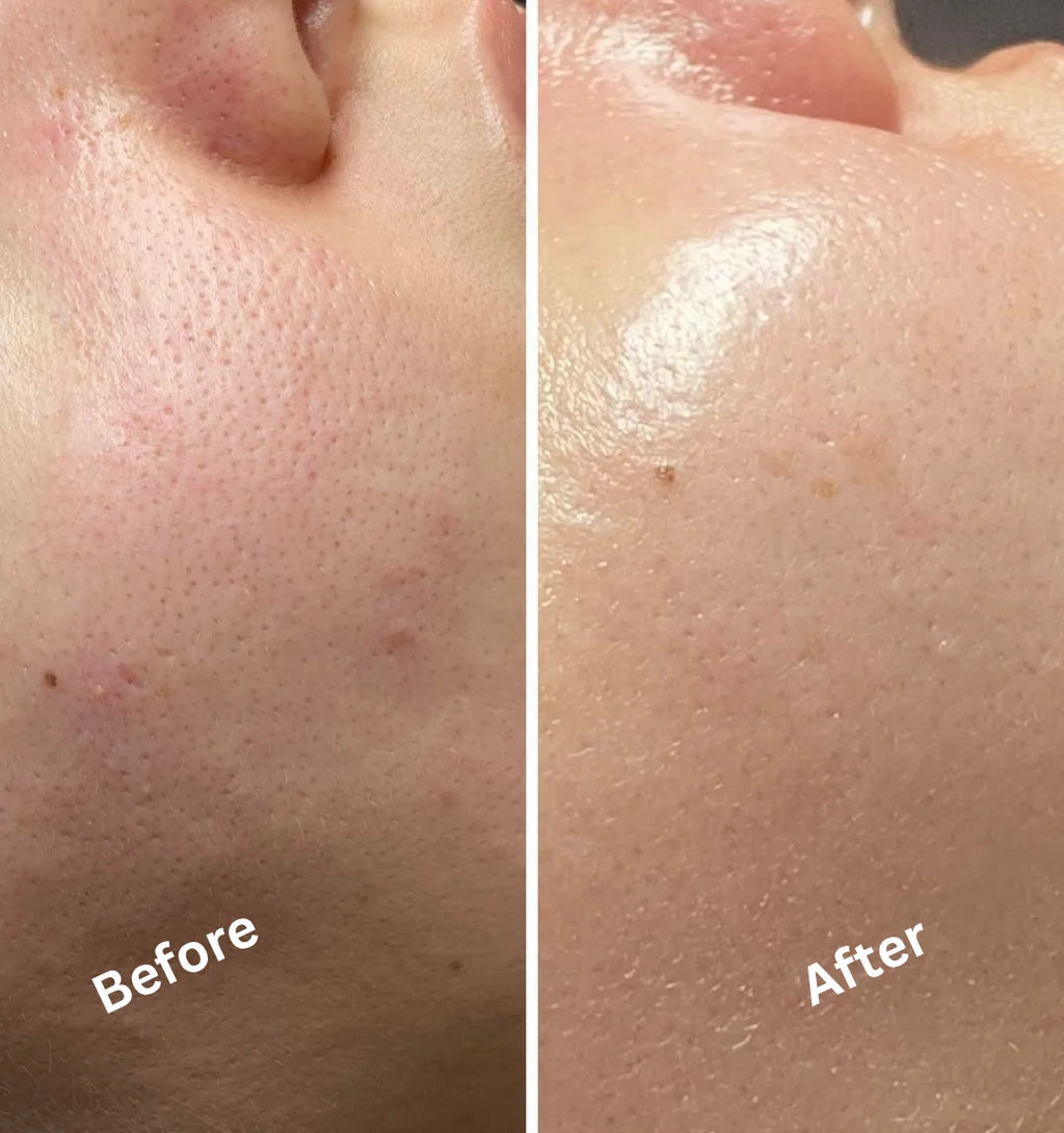 Niacinamide & Zinc (Face serum)
