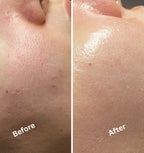 Niacinamide & Zinc (Face serum)