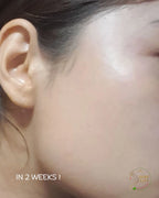 Hyaluronic Acid (Face serum)