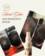 Hair Regrowth Serum