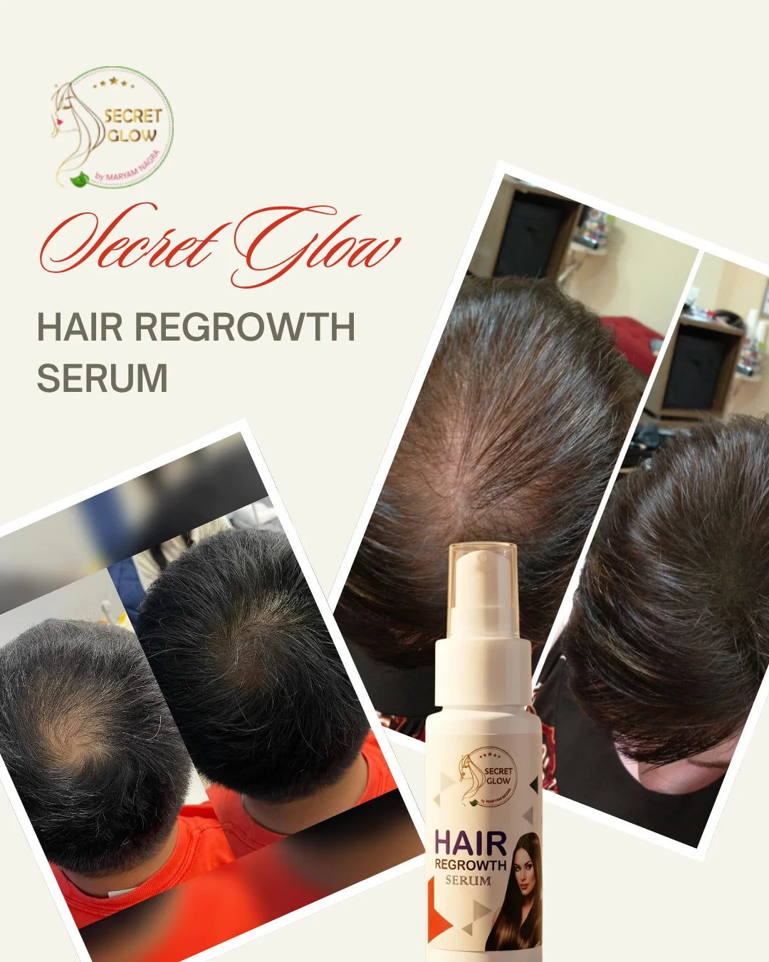 Hair Regrowth Serum