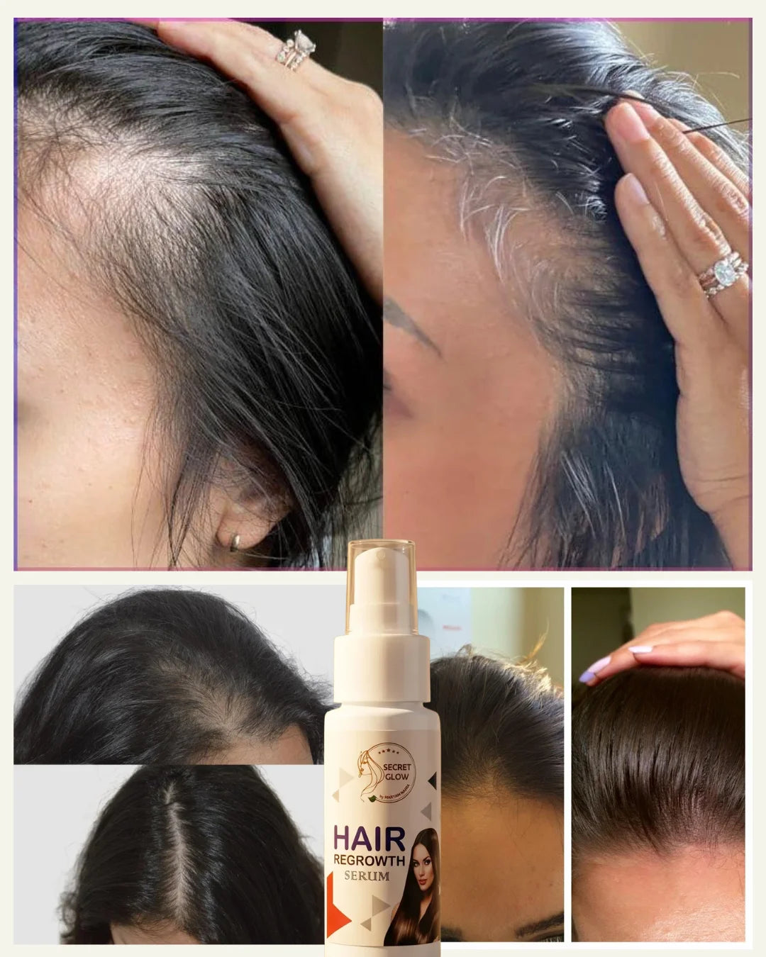 Hair Regrowth Serum