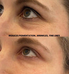Hyaluronic Acid (Face serum)