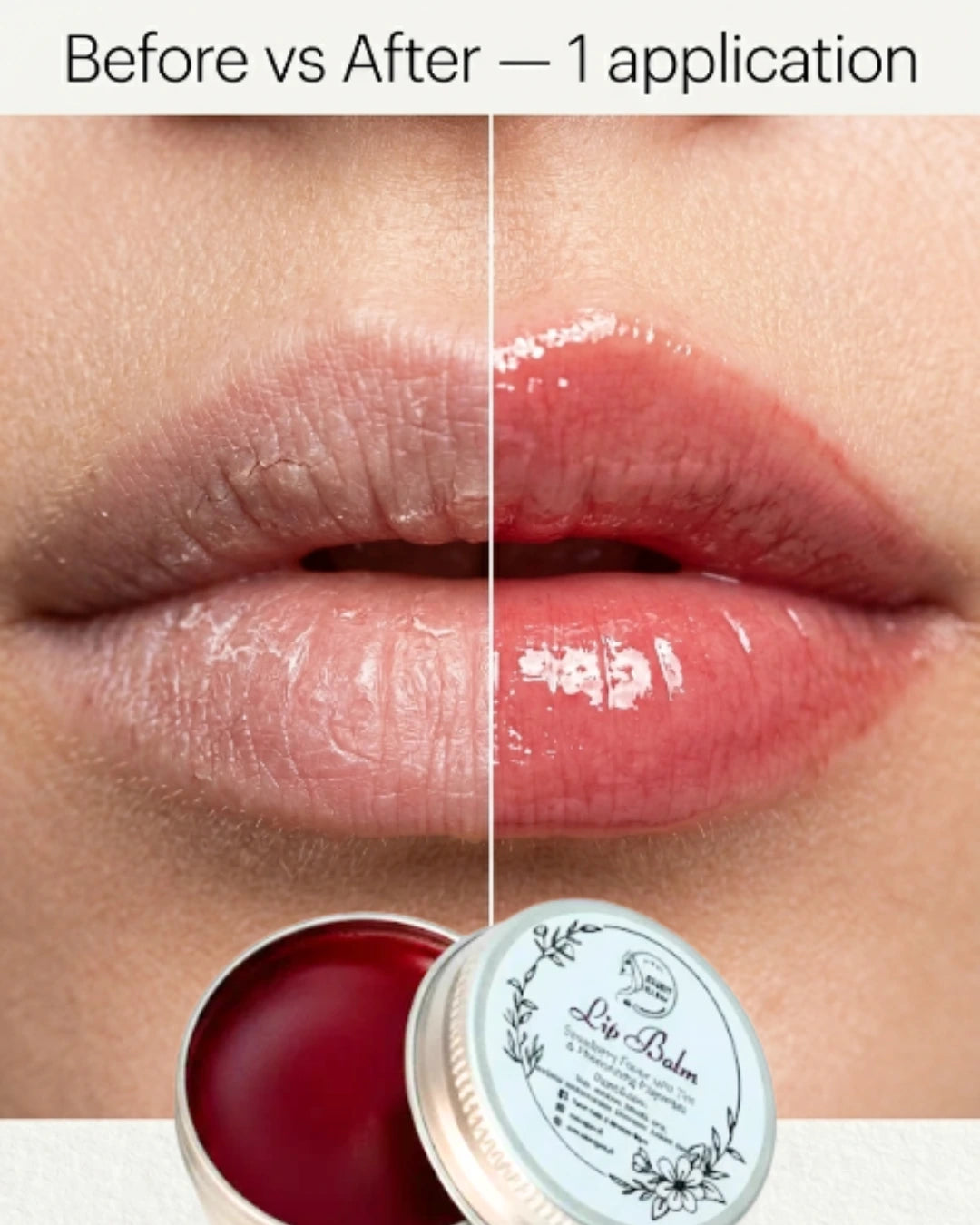Lip Balm