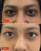 Rocking Roll Dark Circles Serum