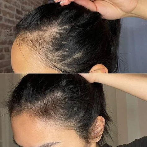 Rosemary Hair Oil | Solution To Your Hair problem