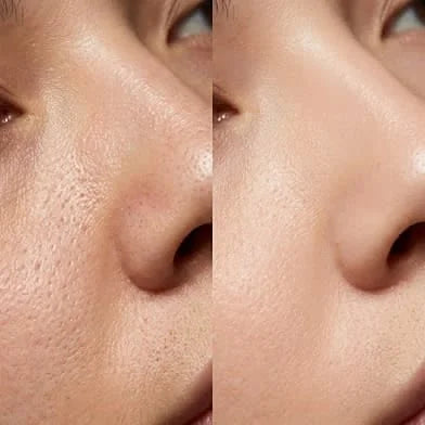 Menthol Pore Minimiser