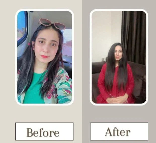 Rosemary Hair Oil | Solution To Your Hair problem