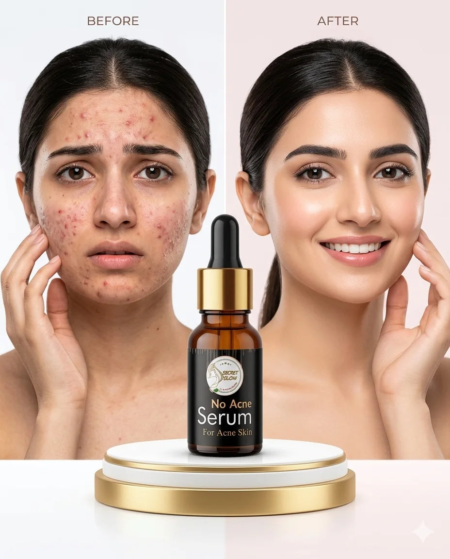 Anti acne (Face serum)