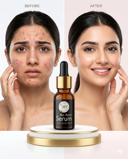 Anti acne (Face serum)