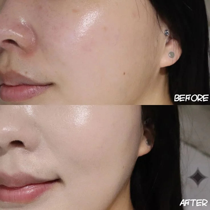 Ice Facial Kit