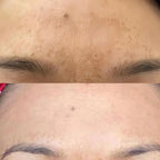 Skin Lightening Cream - 3 Week Brightening Cream