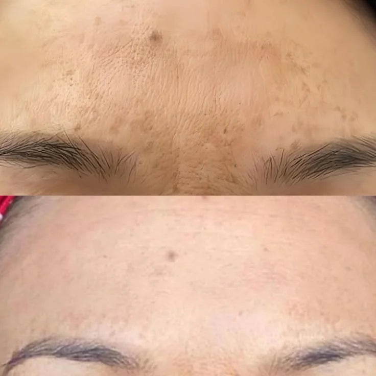 Skin Lightening Cream - 3 Week Brightening Cream