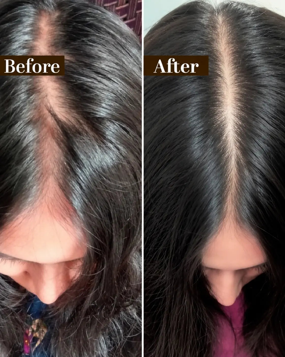 Rosemary Hair Oil | Solution To Your Hair problem