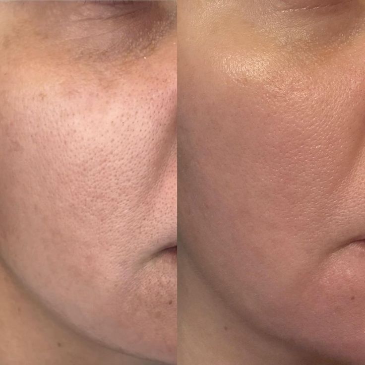 Whitening Soap