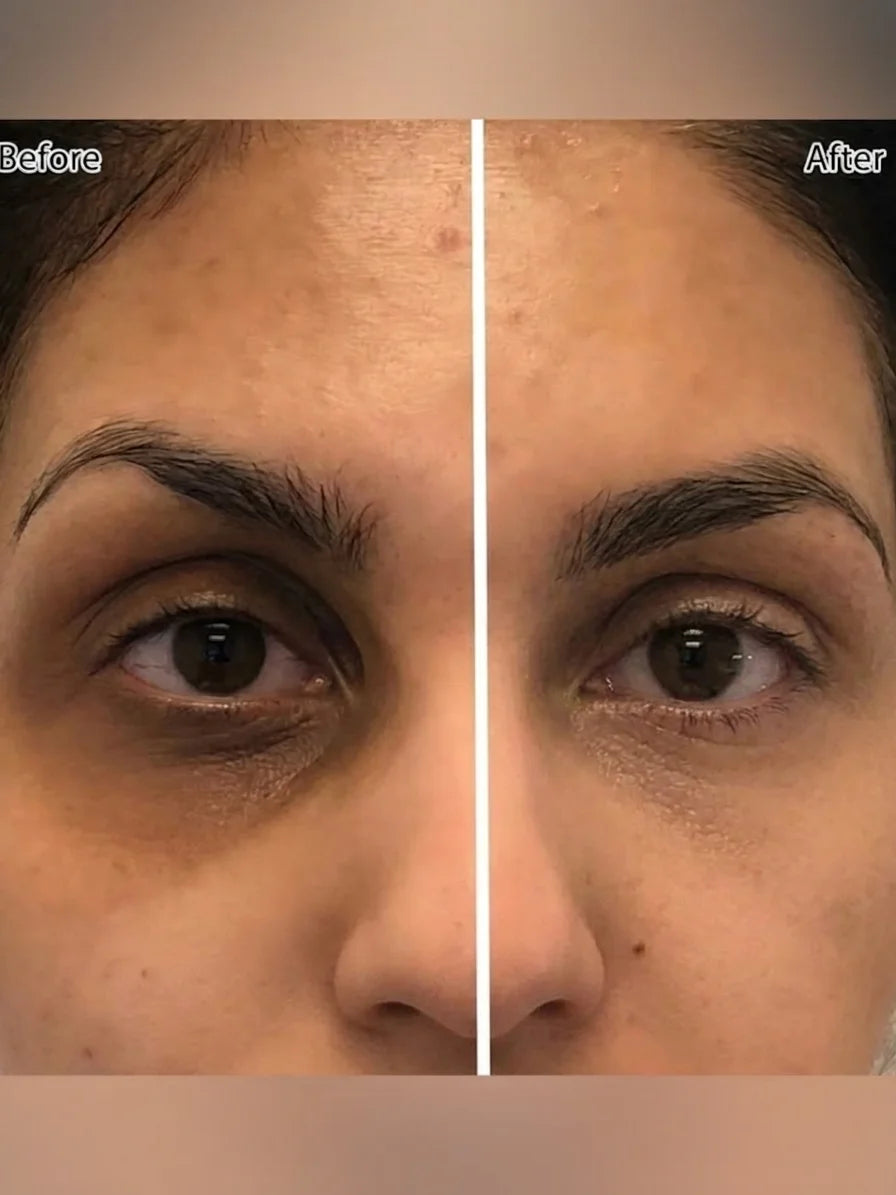 Rocking Roll Dark Circles Serum