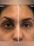 Rocking Roll Dark Circles Serum