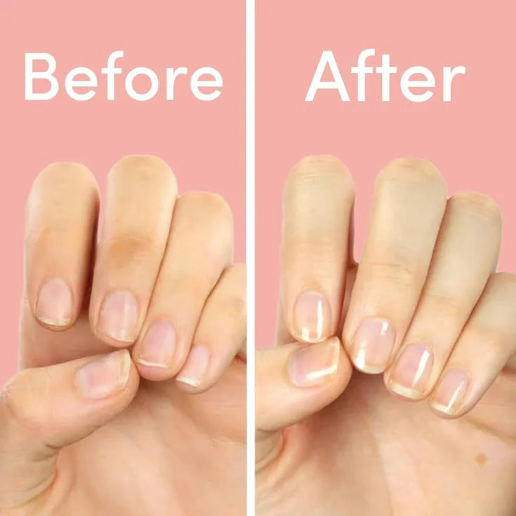 Nail Growth Oil
