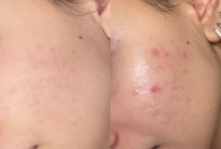 Mandelic Toner