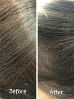 Dandruff Defense shampoo