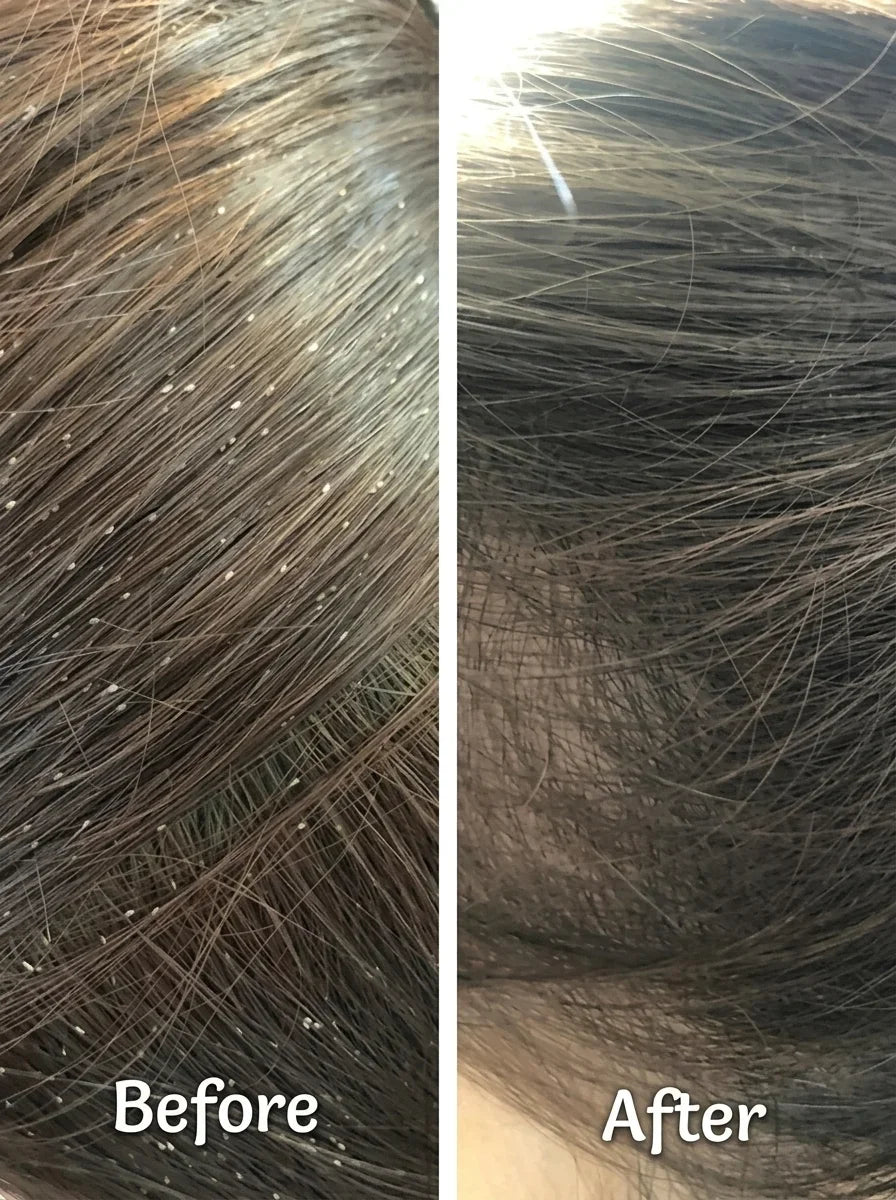 Dandruff Defense shampoo