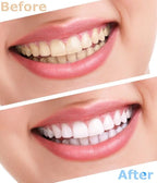 Teeth Whitening Powder