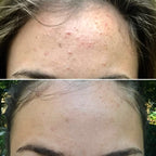 Skin Lightening Cream 3 Week Brightening Cream