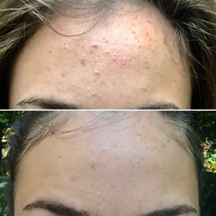 Skin Lightening Cream 3 Week Brightening Cream