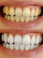 Teeth Whitening Powder