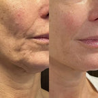 Anti Aging Kit