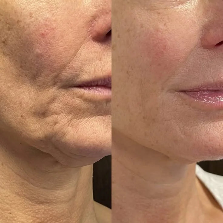 Anti Aging Kit