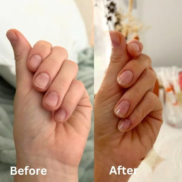 Nail Growth Oil