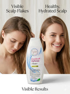 Dandruff Defense shampoo