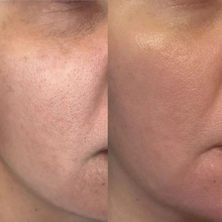 Whitening Soap
