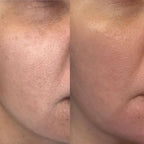 Whitening Soap