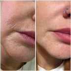 Anti Aging Kit