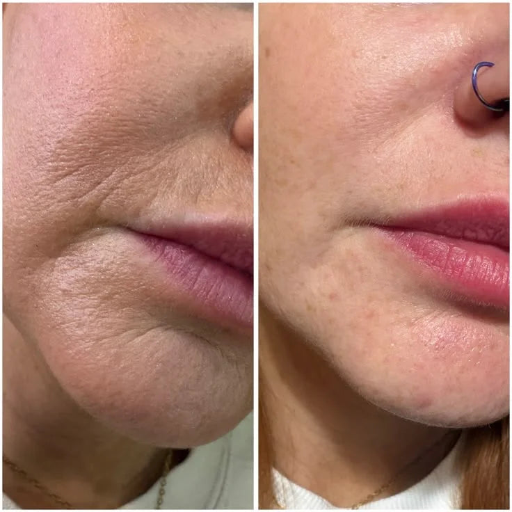 Anti Aging Kit