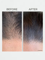 Hair Oil