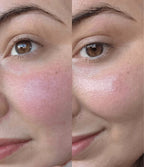 Baby Cream Moisturizer