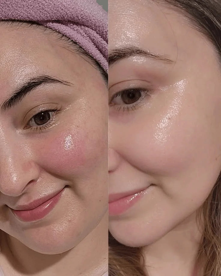 Baby Cream Moisturizer