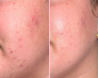 Mandelic Toner