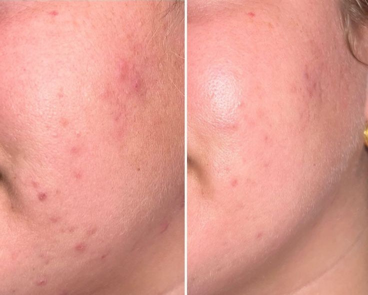 Mandelic Toner