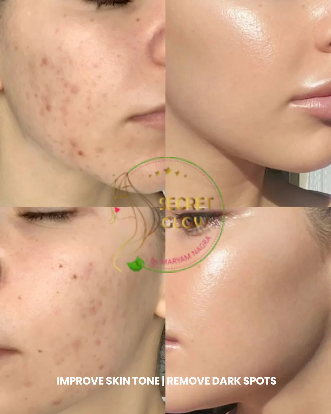 Alpha Arbutin (Face serum)