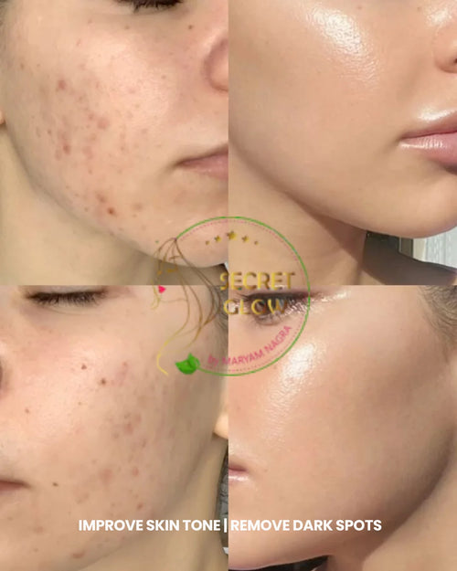 Alpha Arbutin (Face serum)
